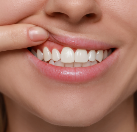 GENERAL DENTISTRY